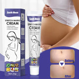 Détail matière — Remove Pregnancy Stretch Marks Cream Improves E
