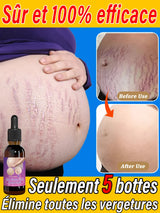 Body essential oil suitable for pregnant women, BUY 10 GET 12 FREE en situation d'utilisation