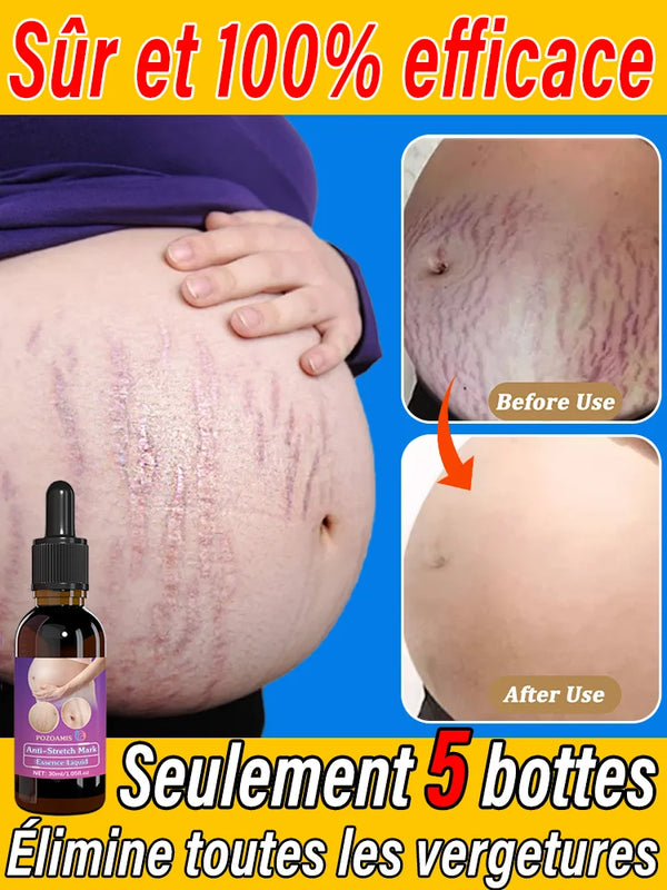Body essential oil suitable for pregnant women, BUY 10 GET 12 FREE en situation d'utilisation