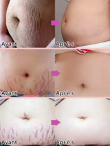 Body essential oil suitable for pregnant women, avec accessoires inclus | Bouni